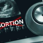 Ultrasound, stethoscope, and ABORTION crossed out in red.