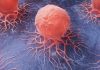 Cancer cells spreading on a blue surface.