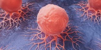 Cancer cells spreading on a blue surface.