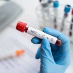 Gloved hand holding a blood sample tube labeled for HIV test
