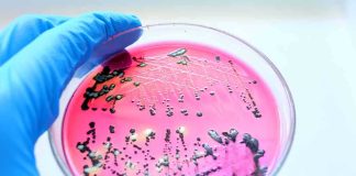 Sugar Supercharges Hospital Superbug Gloved hand holding petri dish with bacterial colonies on pink agar